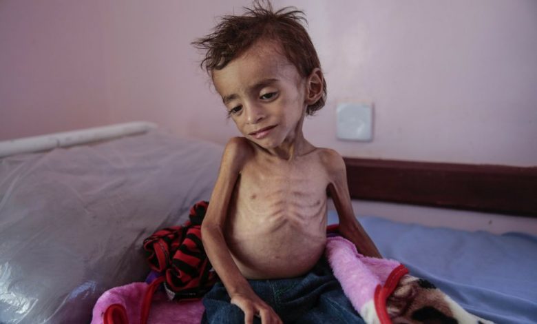 hunger-in-yemen.jpeg